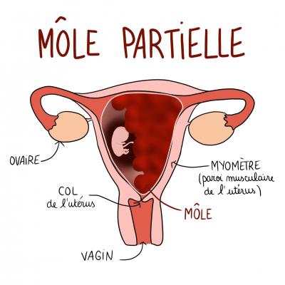 Mole partielle